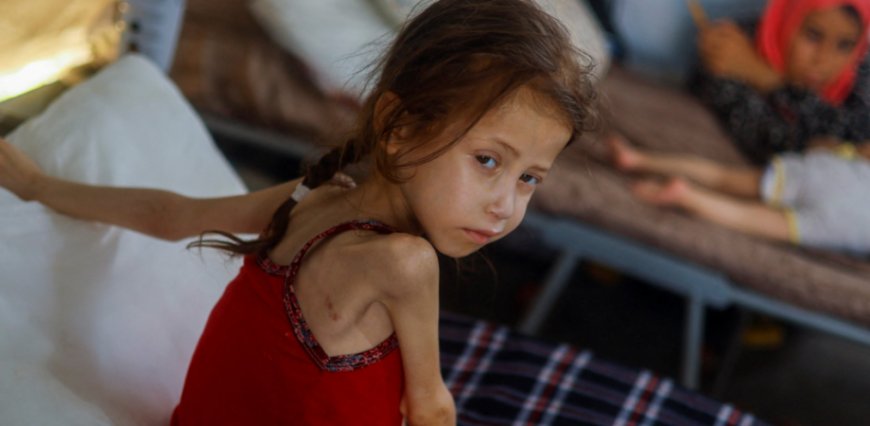 Starvation in Gaza Deepens Amid Intensifying Conflict and Israeli Strikes in Syria