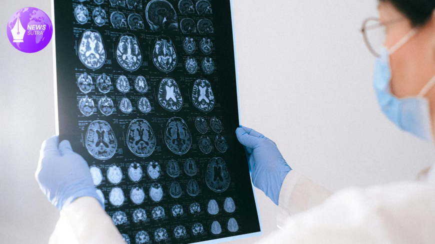 A Clearer Mind: Breakthroughs in Non-Invasive Brain Imaging for Mental Health